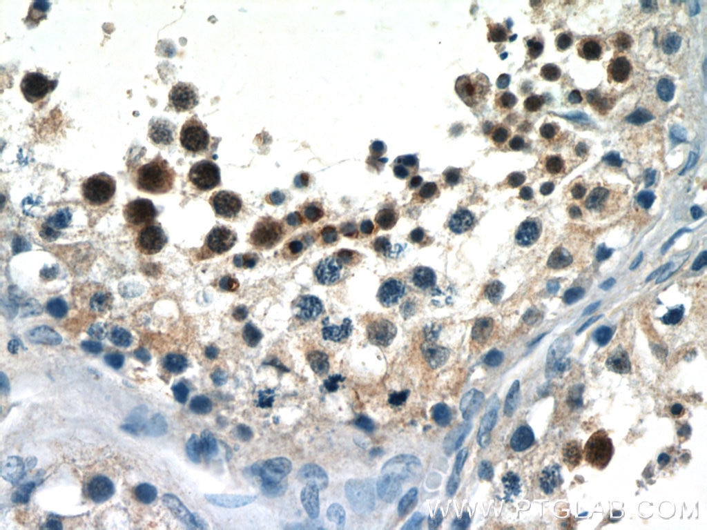 IHC staining of human testis using 24500-1-AP