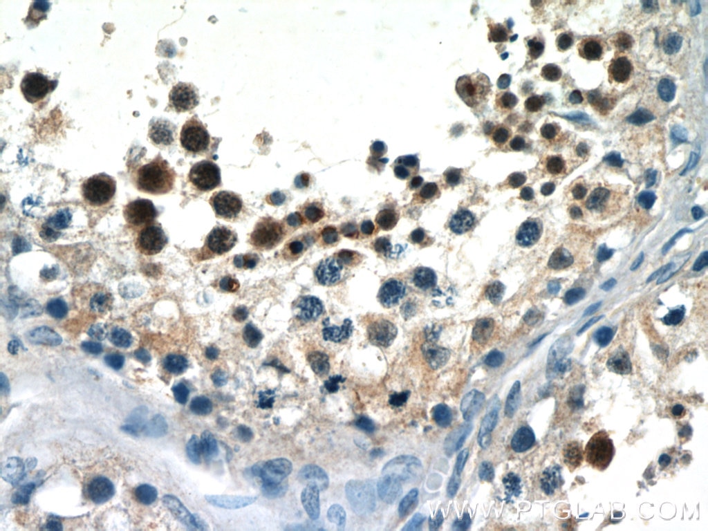 Immunohistochemistry (IHC) staining of human testis tissue using SALL4 Polyclonal antibody (24500-1-AP)