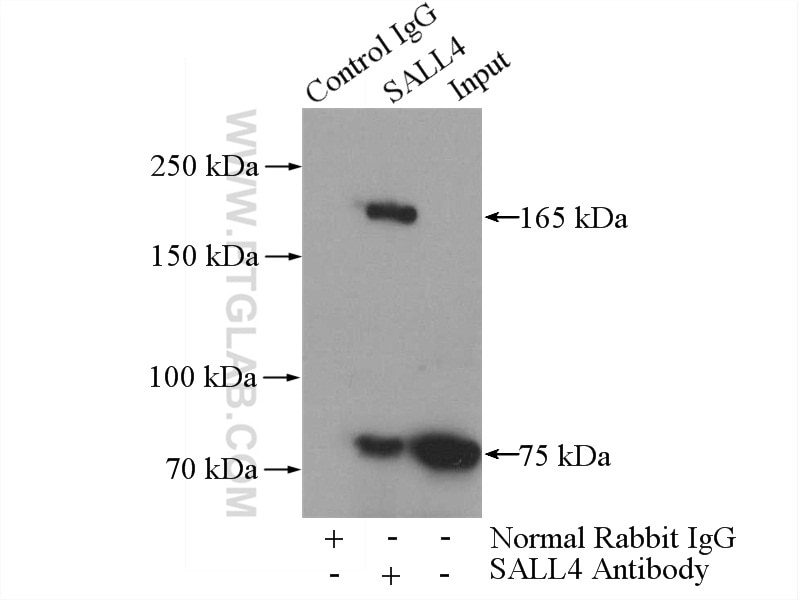Immunoprecipitation (IP) experiment of HepG2 cells using SALL4 Polyclonal antibody (24500-1-AP)