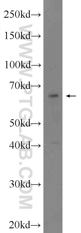 Western Blot (WB) analysis of HepG2 cells using SALL4 Polyclonal antibody (24500-1-AP)