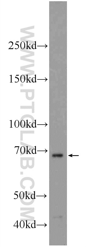 Western Blot (WB) analysis of HepG2 cells using SALL4 Polyclonal antibody (24500-1-AP)