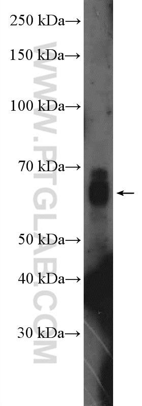 Western Blot (WB) analysis of rat liver tissue using SALL4 Polyclonal antibody (24500-1-AP)