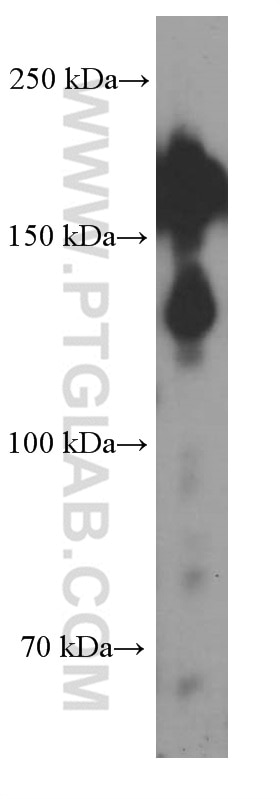 Western Blot (WB) analysis of K-562 cells using SALL4 Monoclonal antibody (66236-1-Ig)