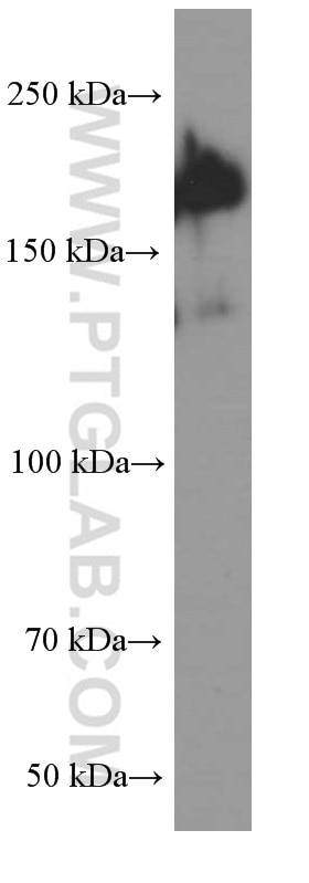 Western Blot (WB) analysis of K-562 cells using SALL4 Monoclonal antibody (66236-1-Ig)