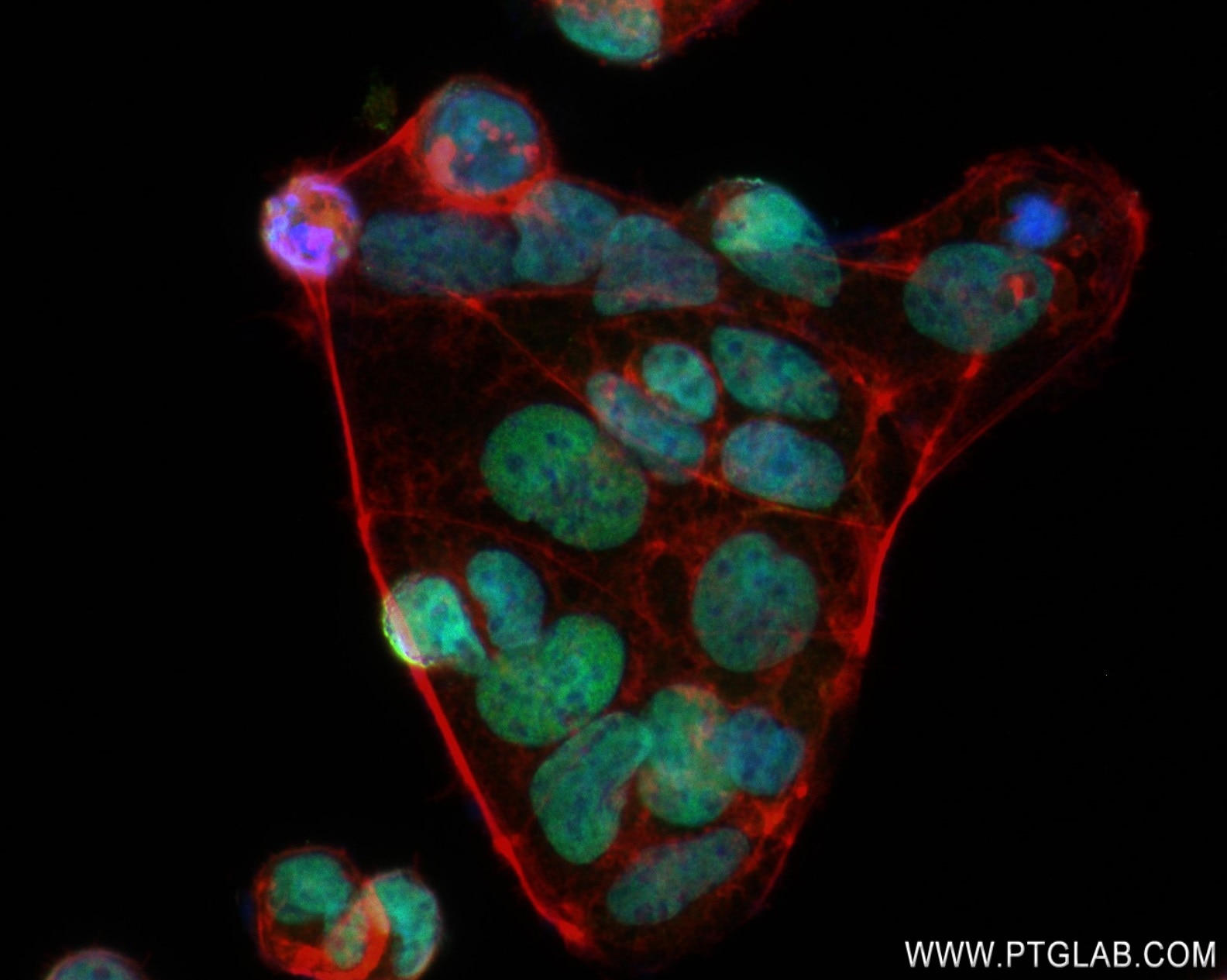 Immunofluorescence (IF) / fluorescent staining of Caco-2 cells using SALL4 Recombinant antibody (83039-4-RR)