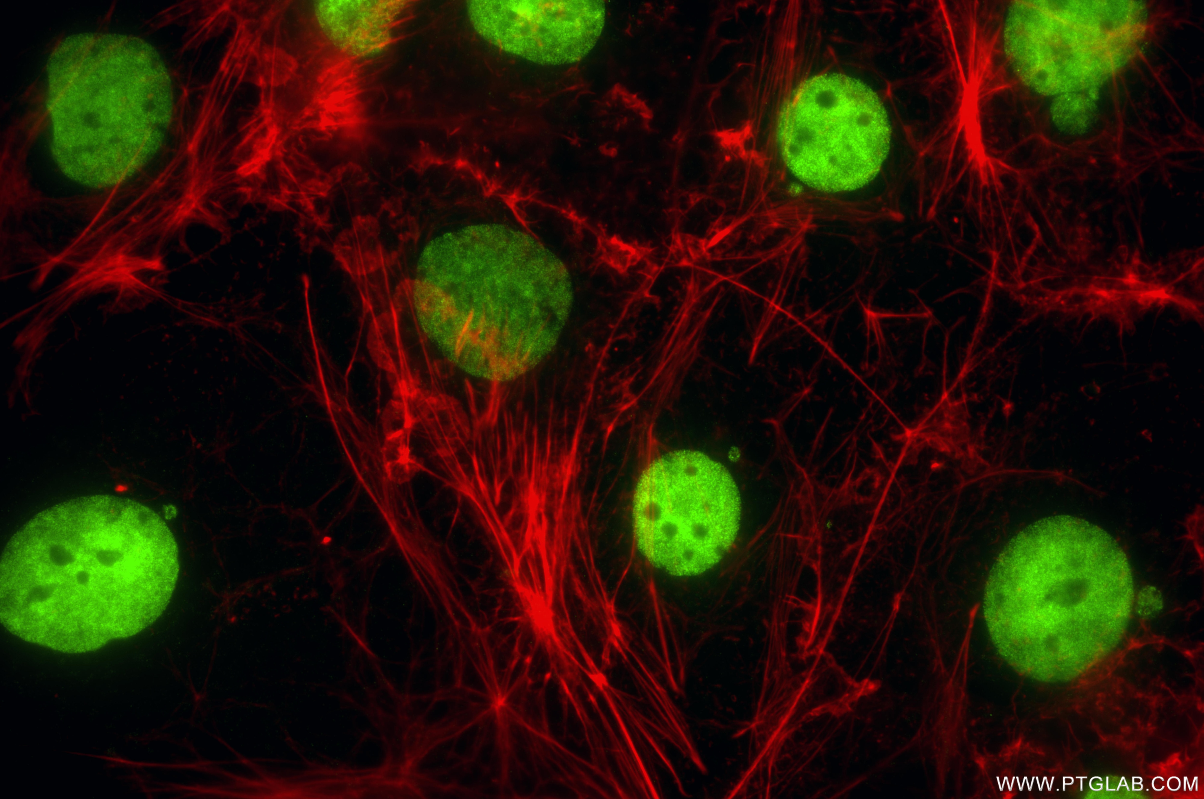Immunofluorescence (IF) / fluorescent staining of Caco-2 cells using SALL4 Recombinant monoclonal antibody (83039-7-RR)
