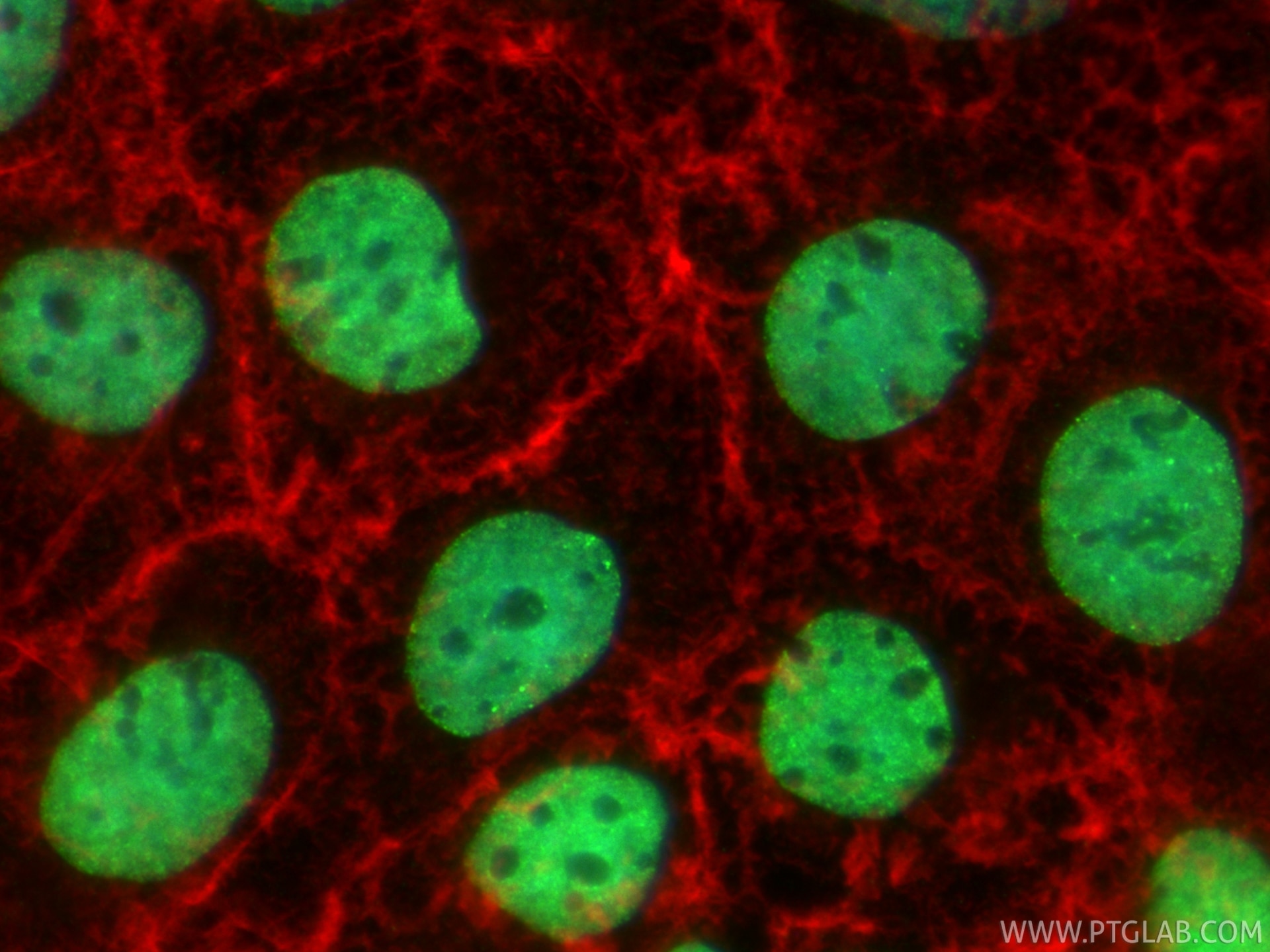 IF Staining of Caco-2 using 83039-8-RR Immunofluorescence (IF) / fluorescent staining of Caco-2 cells using SALL4 Recombinant monoclonal antibody (83039-8-RR)