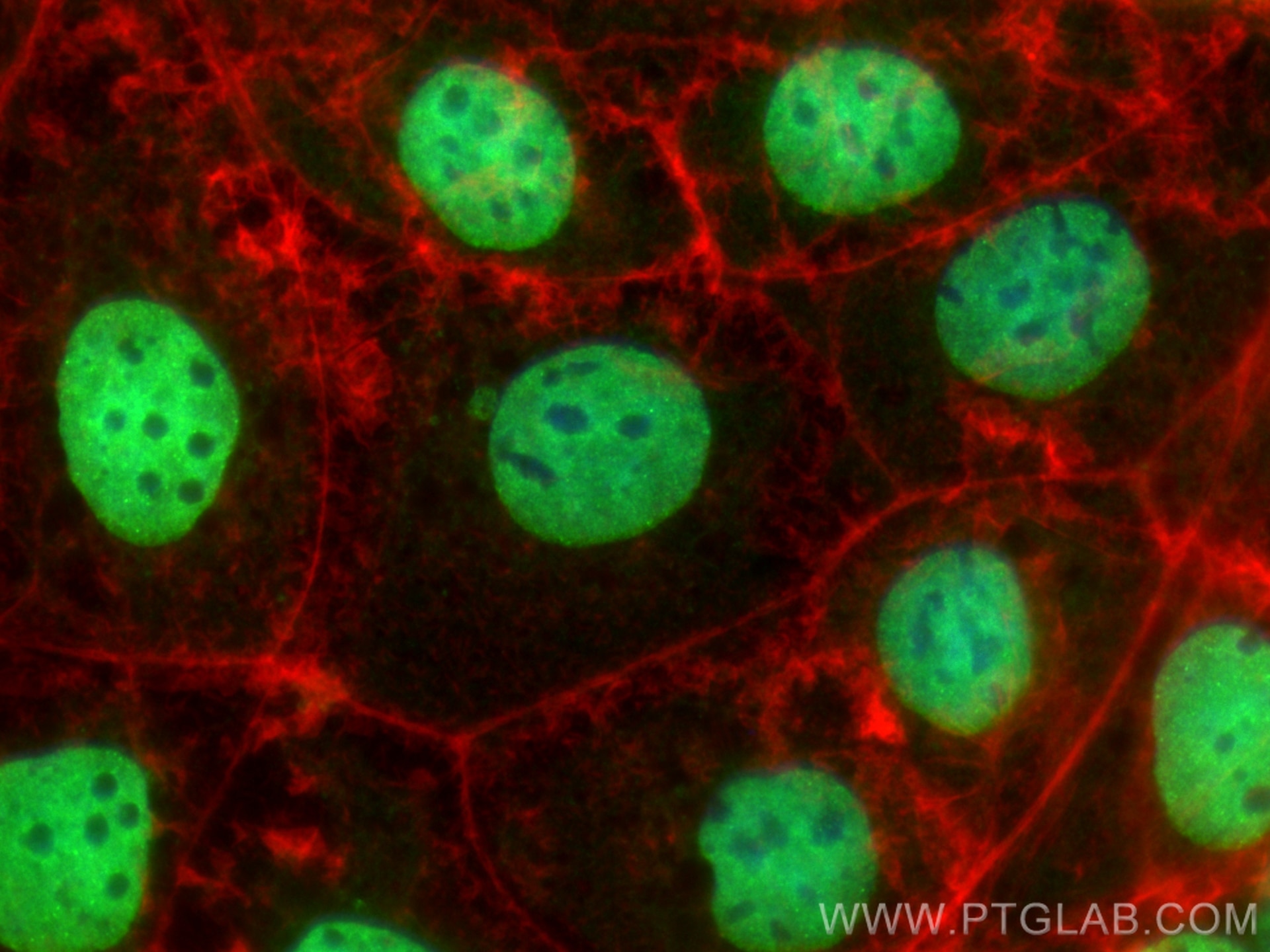 Immunofluorescence (IF) / fluorescent staining of Caco-2 cells using CoraLite® Plus 488-conjugated SALL4 Polyclonal ant (CL488-24500)