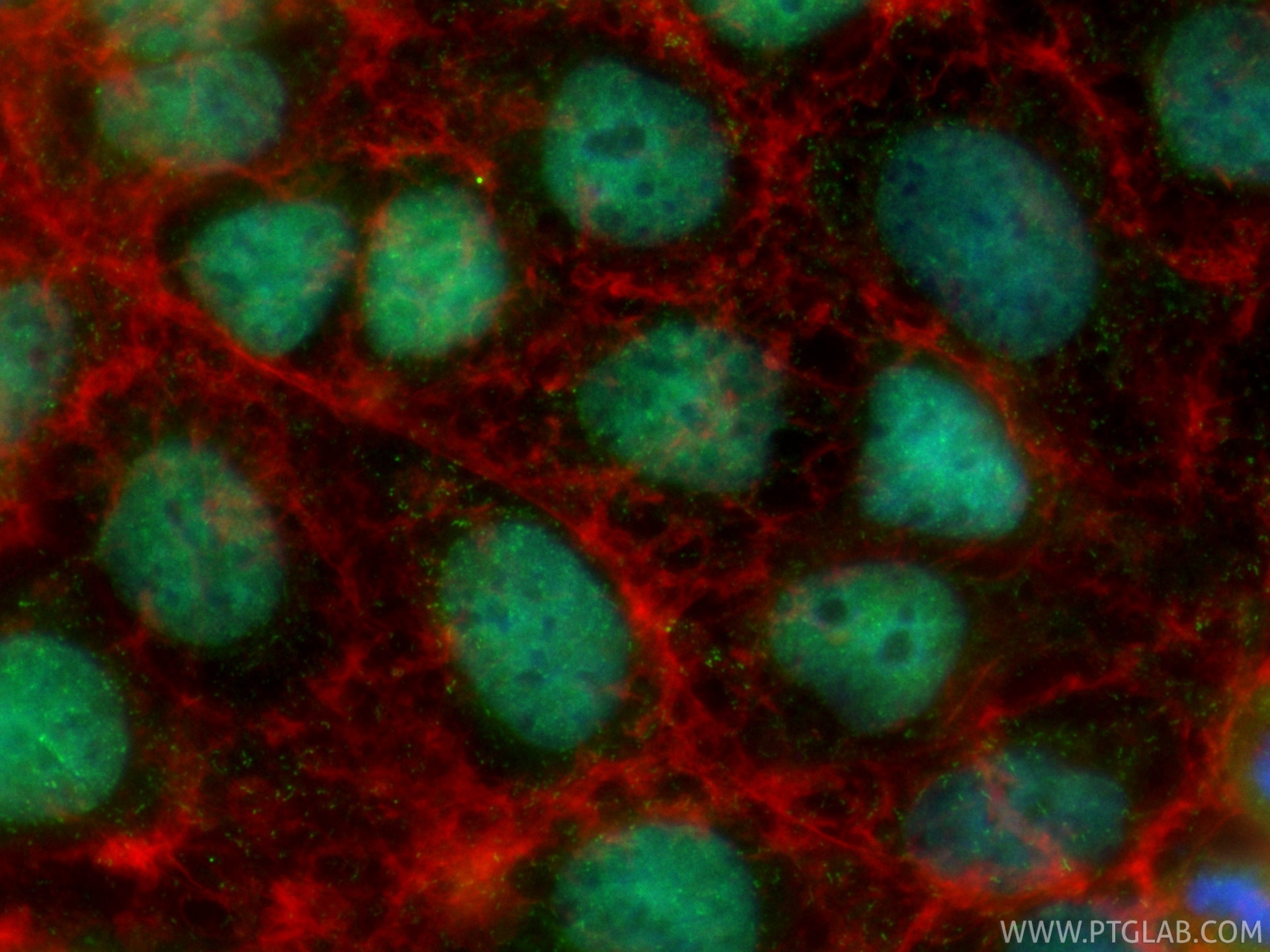 Immunofluorescence (IF) / fluorescent staining of Caco-2 cells using CoraLite® Plus 488-conjugated SALL4 Recombinant mo (CL488-83039-8)