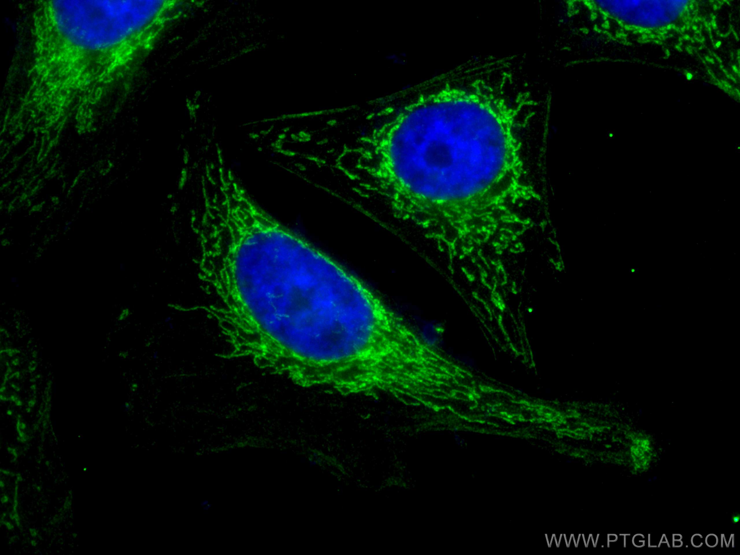 Immunofluorescence (IF) / fluorescent staining of HeLa cells using Sam50 Monoclonal antibody (67425-1-Ig)