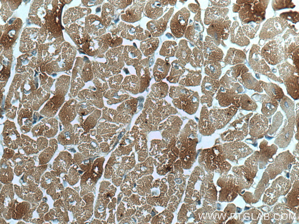 Immunohistochemistry (IHC) staining of human heart tissue using Sam50 Monoclonal antibody (67425-1-Ig)