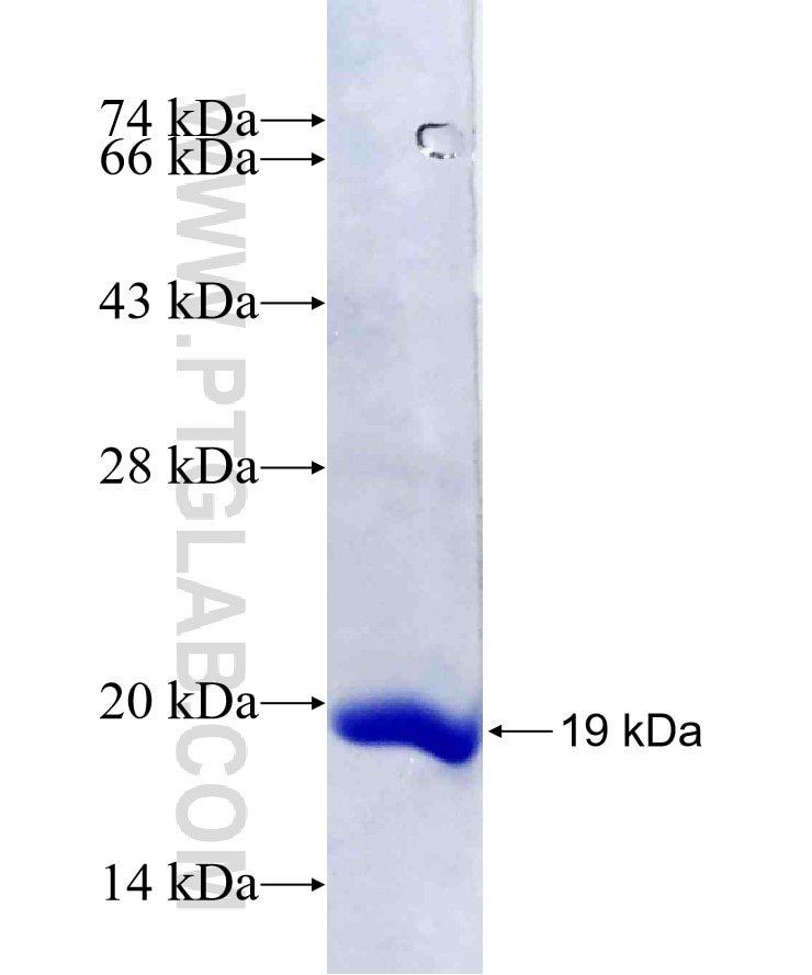 SAMD10 fusion protein Ag22007 SDS-PAGE
