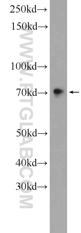 Western Blot (WB) analysis of HEK-293 cells using SAMD11 Polyclonal antibody (24731-1-AP)