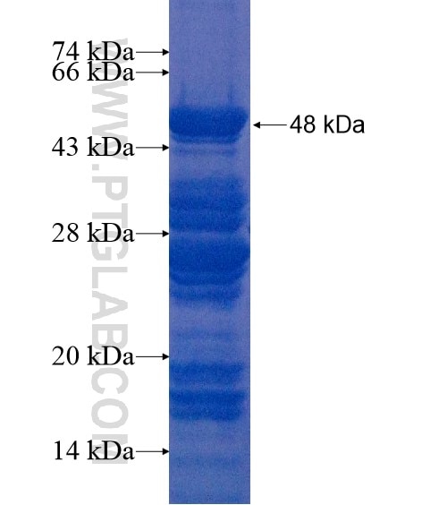 SAMD11 fusion protein Ag20671 SDS-PAGE