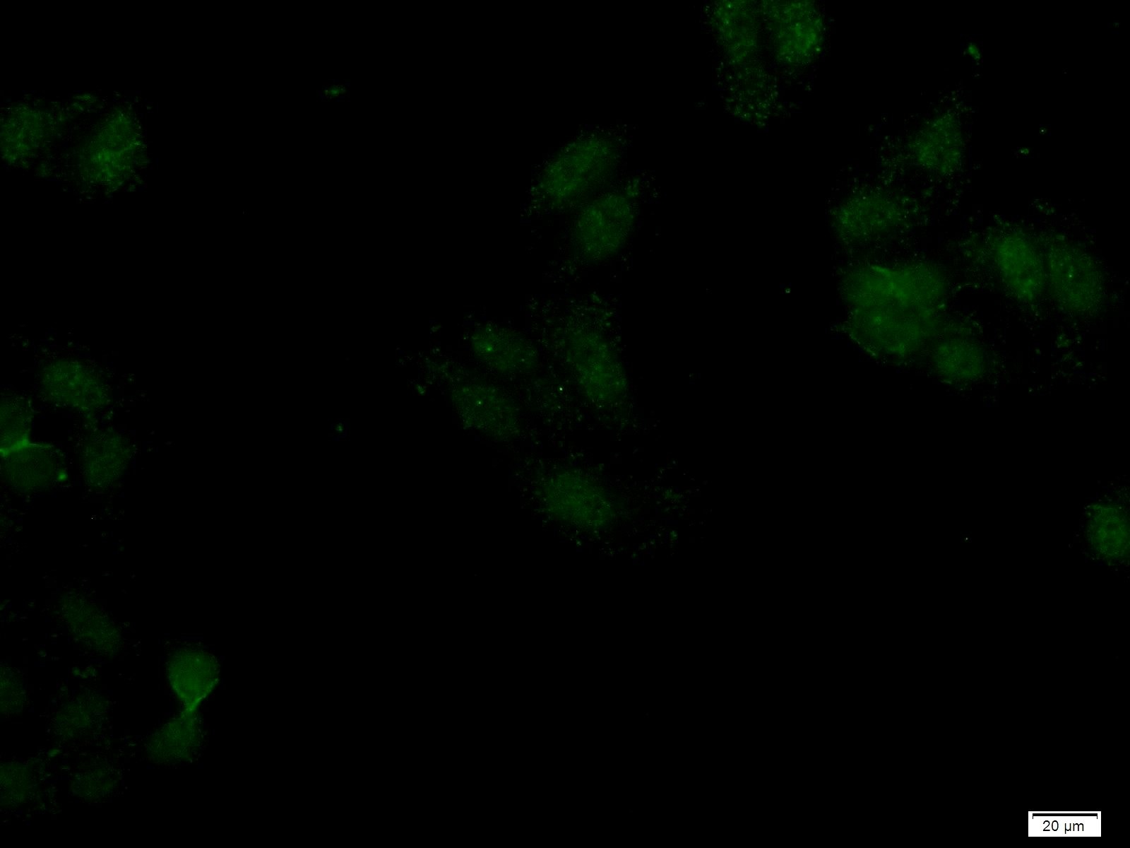 Immunofluorescence (IF) / fluorescent staining of HepG2 cells using SAMD14 Polyclonal antibody (22009-1-AP)