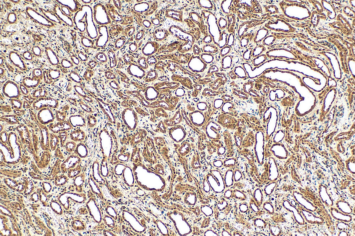 Immunohistochemistry (IHC) staining of human kidney tissue using SAMD14 Polyclonal antibody (22009-1-AP)