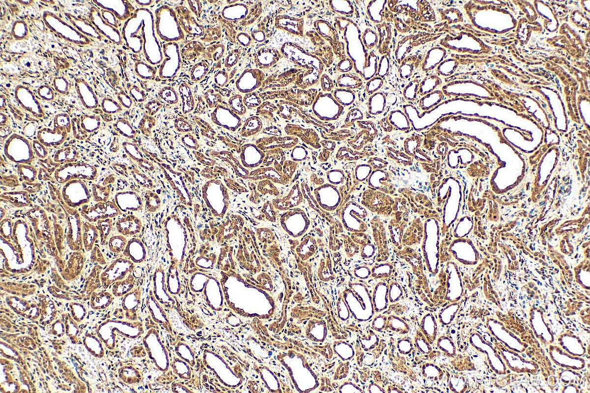 Immunohistochemistry (IHC) staining of human kidney tissue using SAMD14 Polyclonal antibody (22009-1-AP)