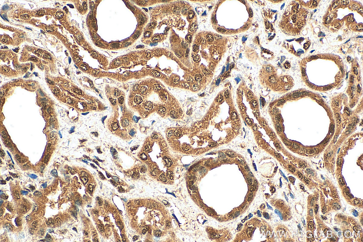 Immunohistochemistry (IHC) staining of human kidney tissue using SAMD14 Polyclonal antibody (22009-1-AP)