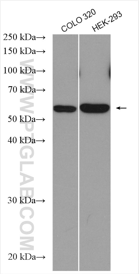Western Blot (WB) analysis of various lysates using SAMD14 Polyclonal antibody (22009-1-AP)