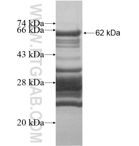 SAMD14 fusion protein Ag15653 SDS-PAGE