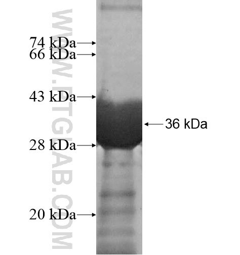 SAMD14 fusion protein Ag15672 SDS-PAGE