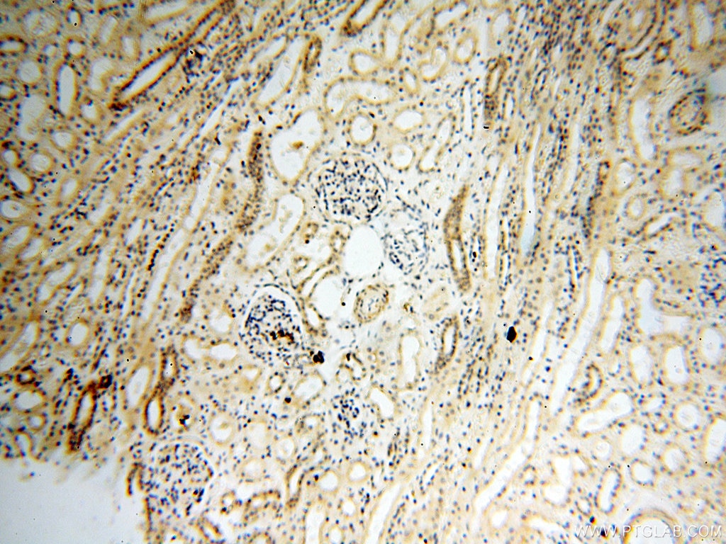 Immunohistochemistry (IHC) staining of human kidney tissue using SAMD4A Polyclonal antibody (17387-1-AP)