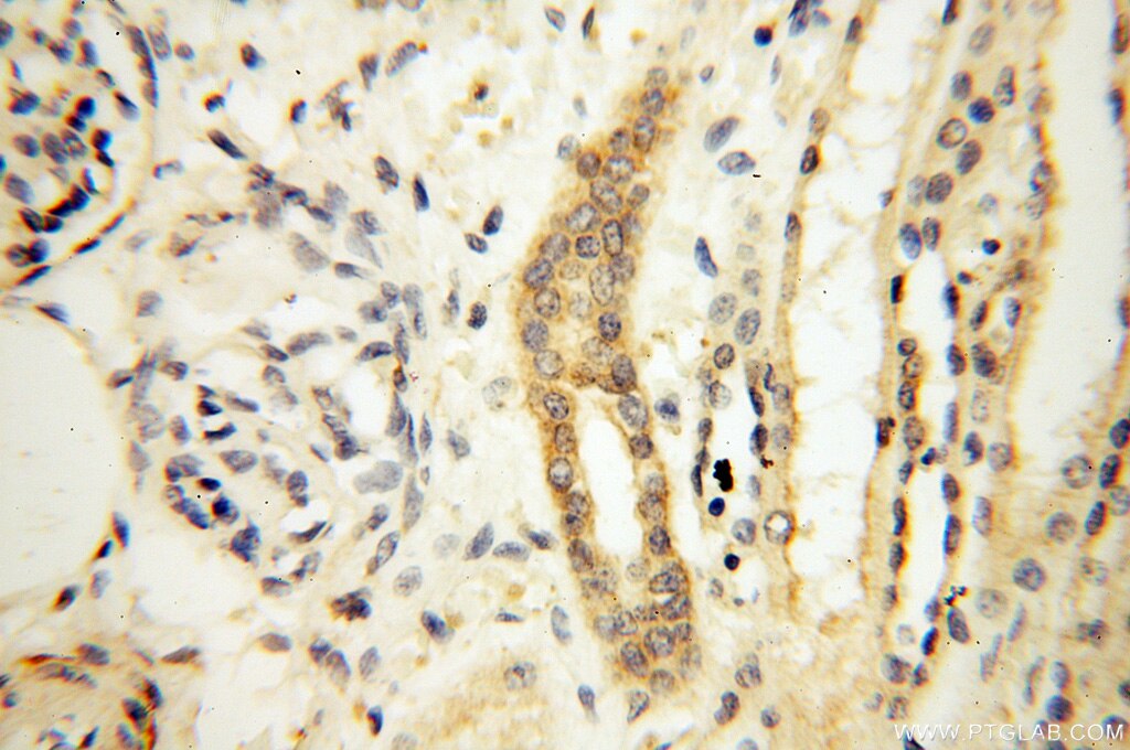 Immunohistochemistry (IHC) staining of human kidney tissue using SAMD4A Polyclonal antibody (17387-1-AP)