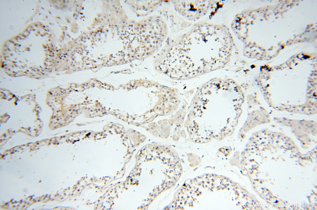 Immunohistochemistry (IHC) staining of human testis tissue using SAMD4A Polyclonal antibody (17387-1-AP)