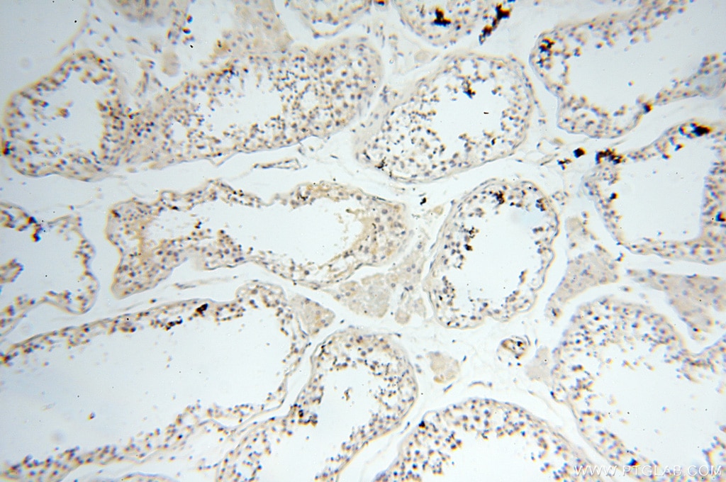 IHC staining of human testis using 17387-1-AP