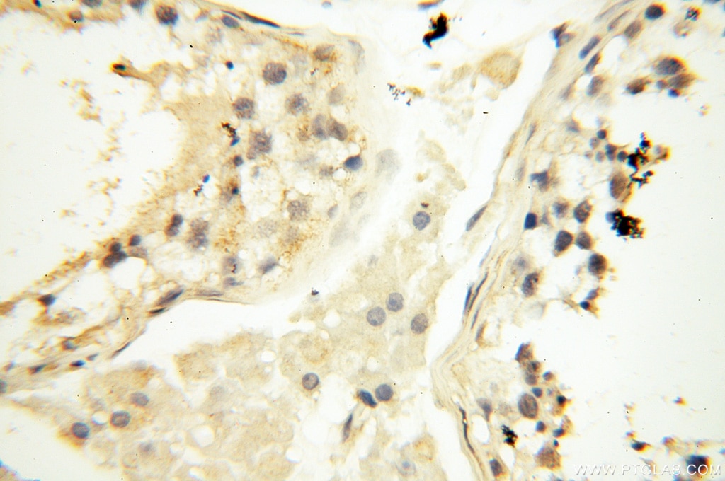 Immunohistochemistry (IHC) staining of human testis tissue using SAMD4A Polyclonal antibody (17387-1-AP)