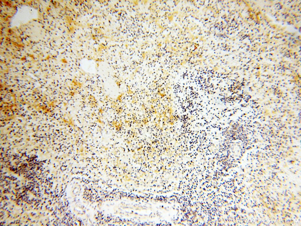 Immunohistochemistry (IHC) staining of human spleen tissue using SAMD4A Polyclonal antibody (17387-1-AP)