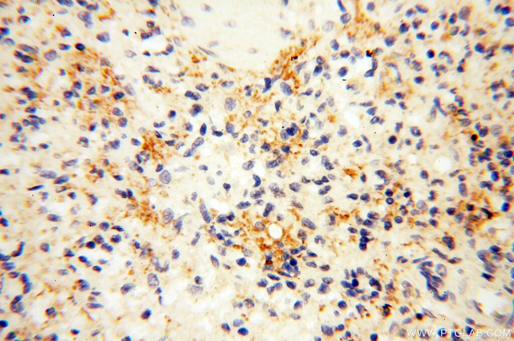 Immunohistochemistry (IHC) staining of human spleen tissue using SAMD4A Polyclonal antibody (17387-1-AP)