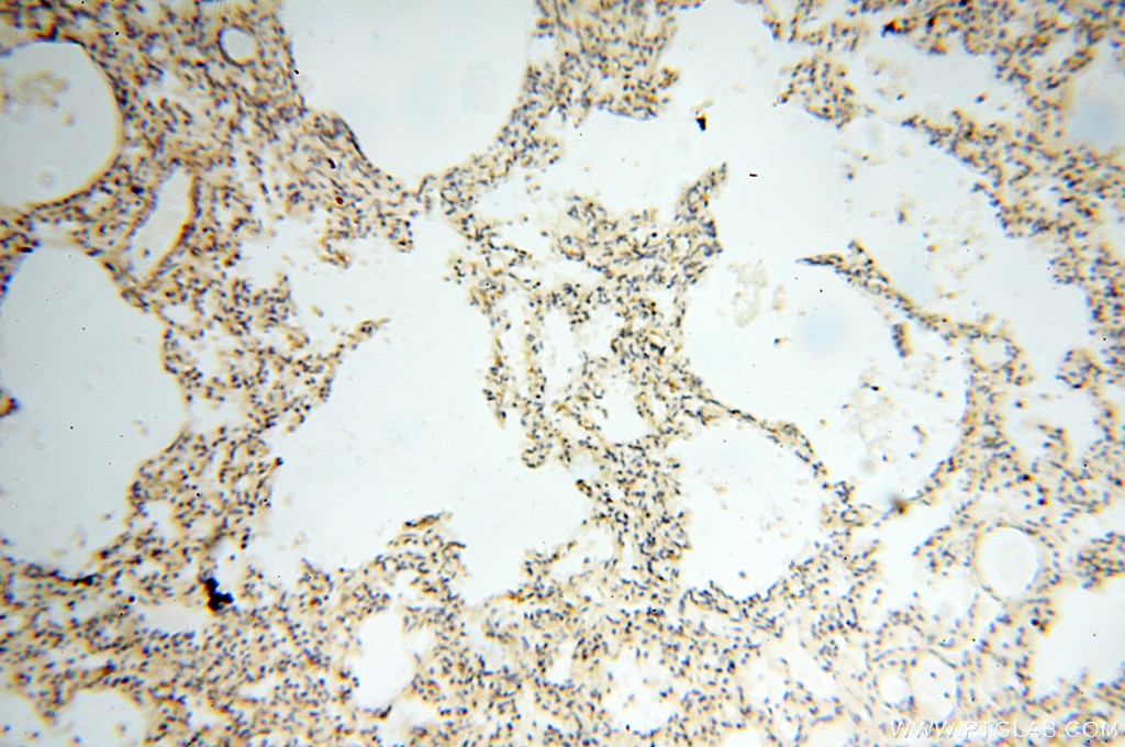 Immunohistochemistry (IHC) staining of human lung tissue using SAMD4A Polyclonal antibody (17387-1-AP)