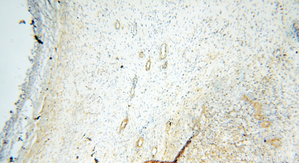 Immunohistochemistry (IHC) staining of human ovary tissue using SAMD4A Polyclonal antibody (17387-1-AP)