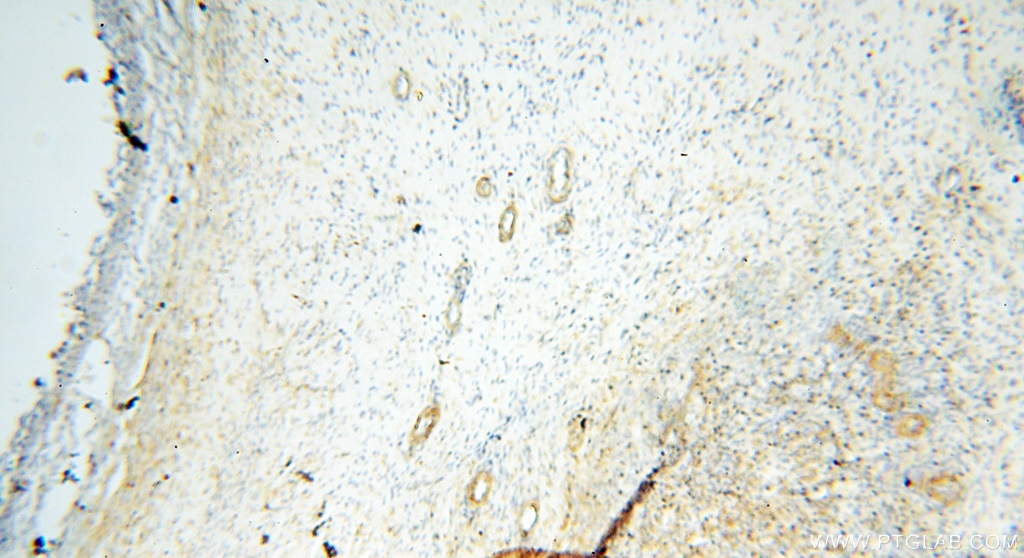 IHC staining of human ovary using 17387-1-AP