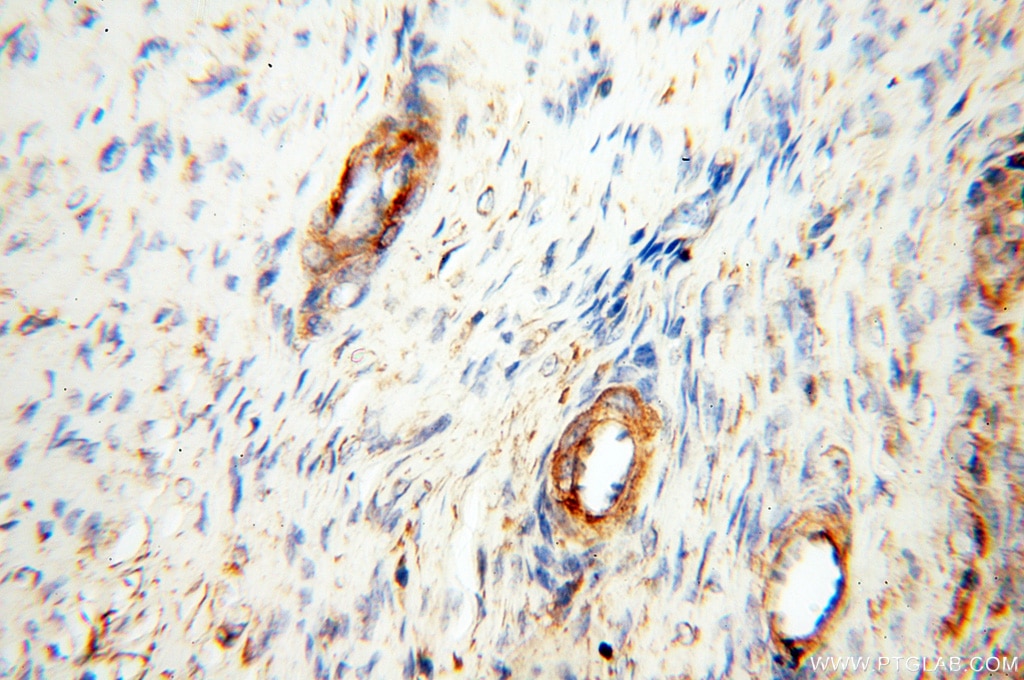 Immunohistochemistry (IHC) staining of human ovary tissue using SAMD4A Polyclonal antibody (17387-1-AP)