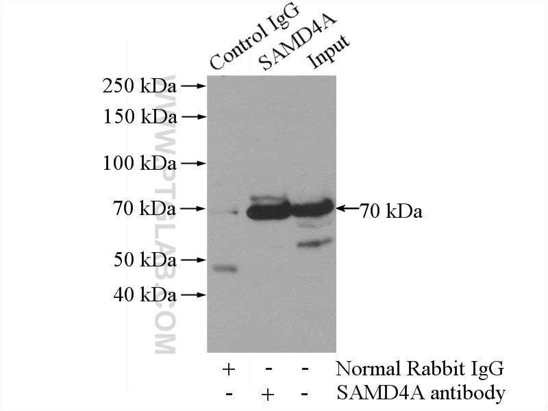 Immunoprecipitation (IP) experiment of mouse skeletal muscle tissue using SAMD4A Polyclonal antibody (17387-1-AP)