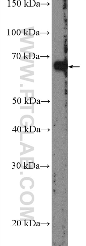Western Blot (WB) analysis of mouse heart tissue using SAMD4A Polyclonal antibody (17387-1-AP)