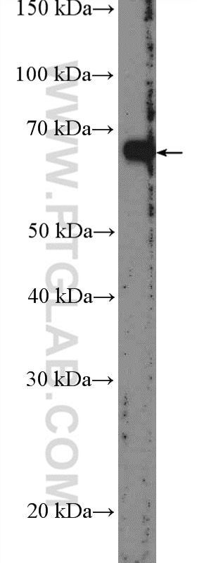 WB analysis of mouse heart using 17387-1-AP