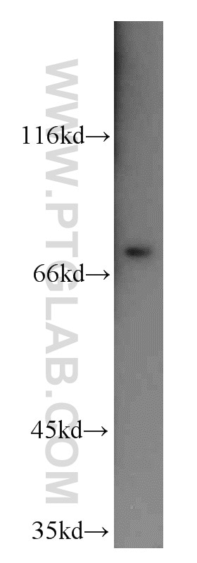 Western Blot (WB) analysis of mouse skeletal muscle tissue using SAMD4A Polyclonal antibody (17387-1-AP)