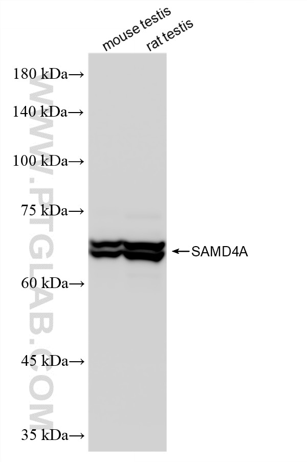 Western Blot (WB) analysis of various lysates using SAMD4A Recombinant antibody (86530-1-RR)