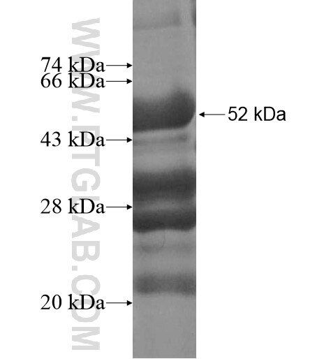 SAMD4A fusion protein Ag10952 SDS-PAGE