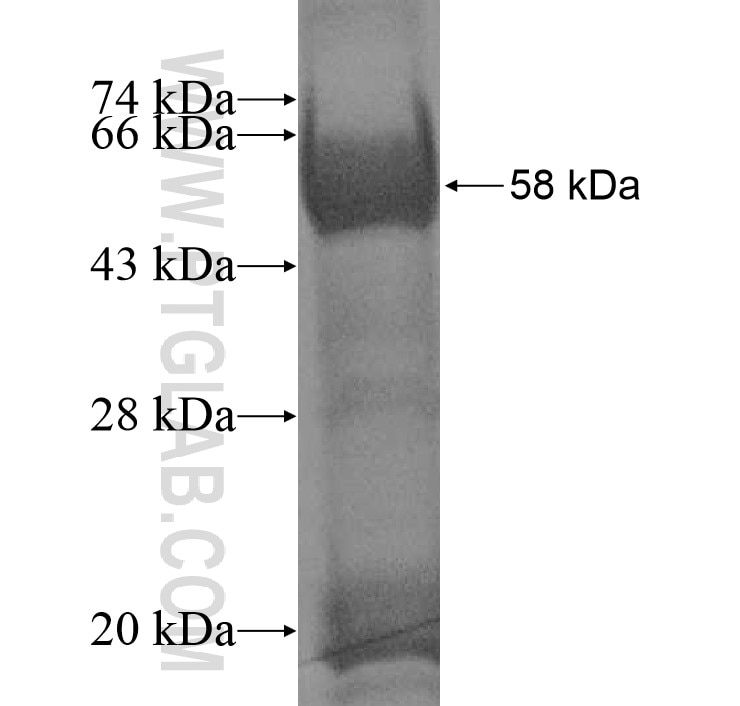 SAMD4A fusion protein Ag11273 SDS-PAGE