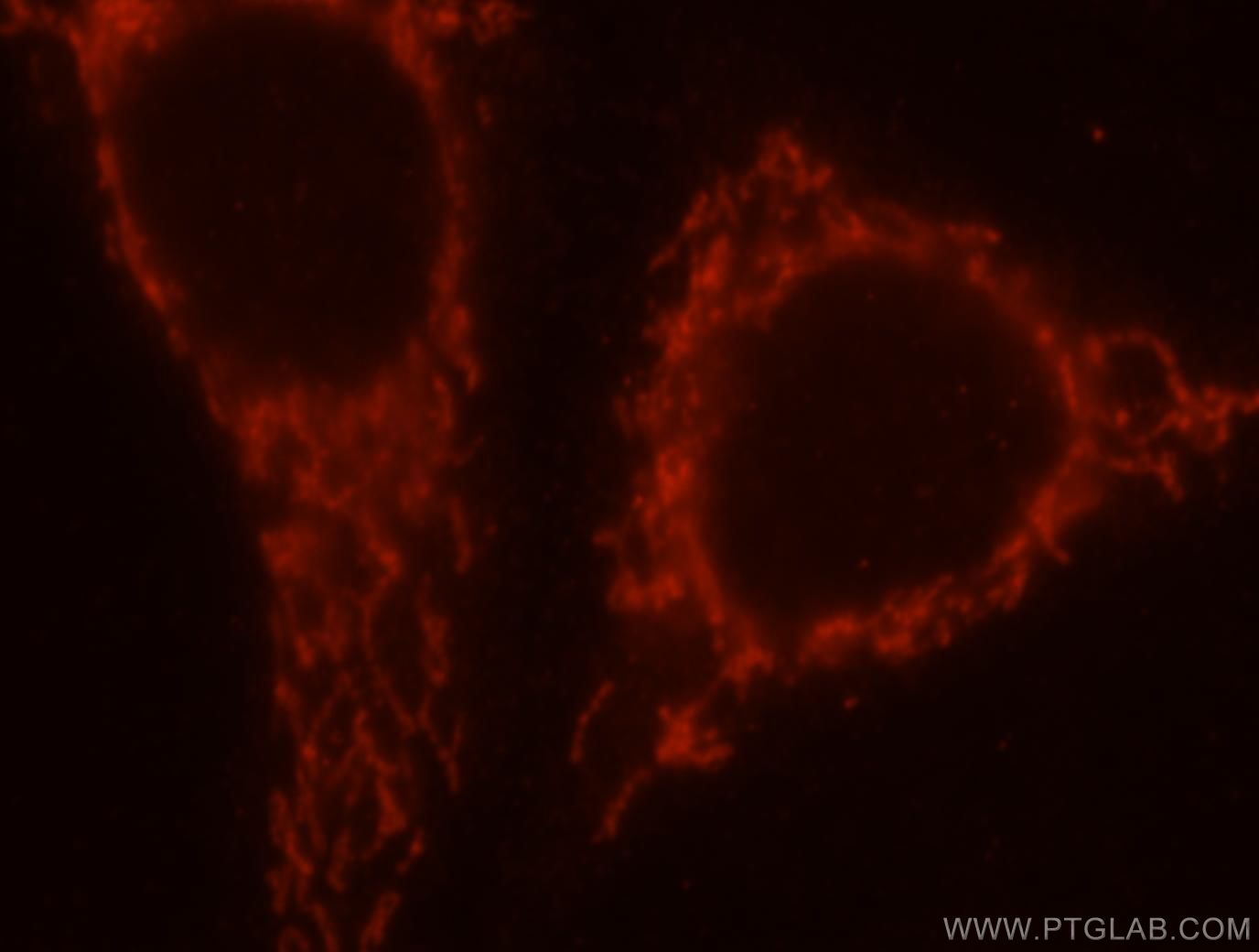 Immunofluorescence (IF) / fluorescent staining of HepG2 cells using SAMD4B Polyclonal antibody (17723-1-AP)