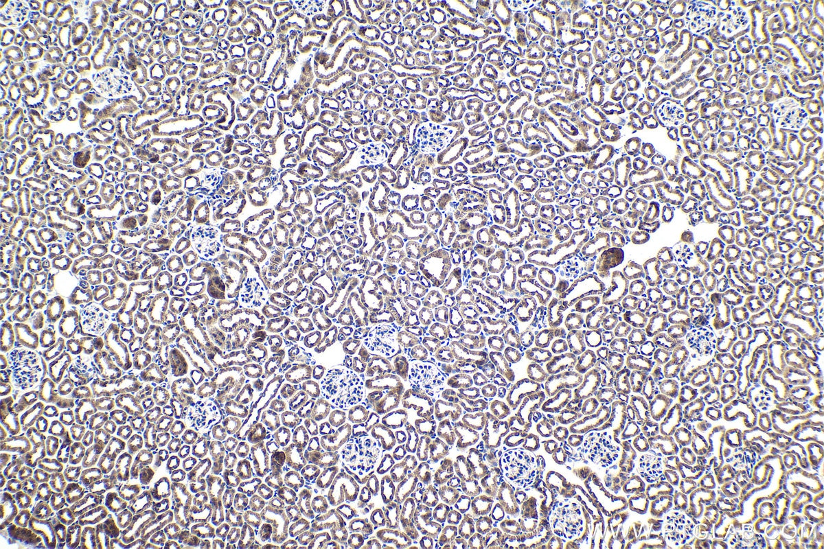Immunohistochemistry (IHC) staining of mouse kidney tissue using SAMD4B Polyclonal antibody (17723-1-AP)