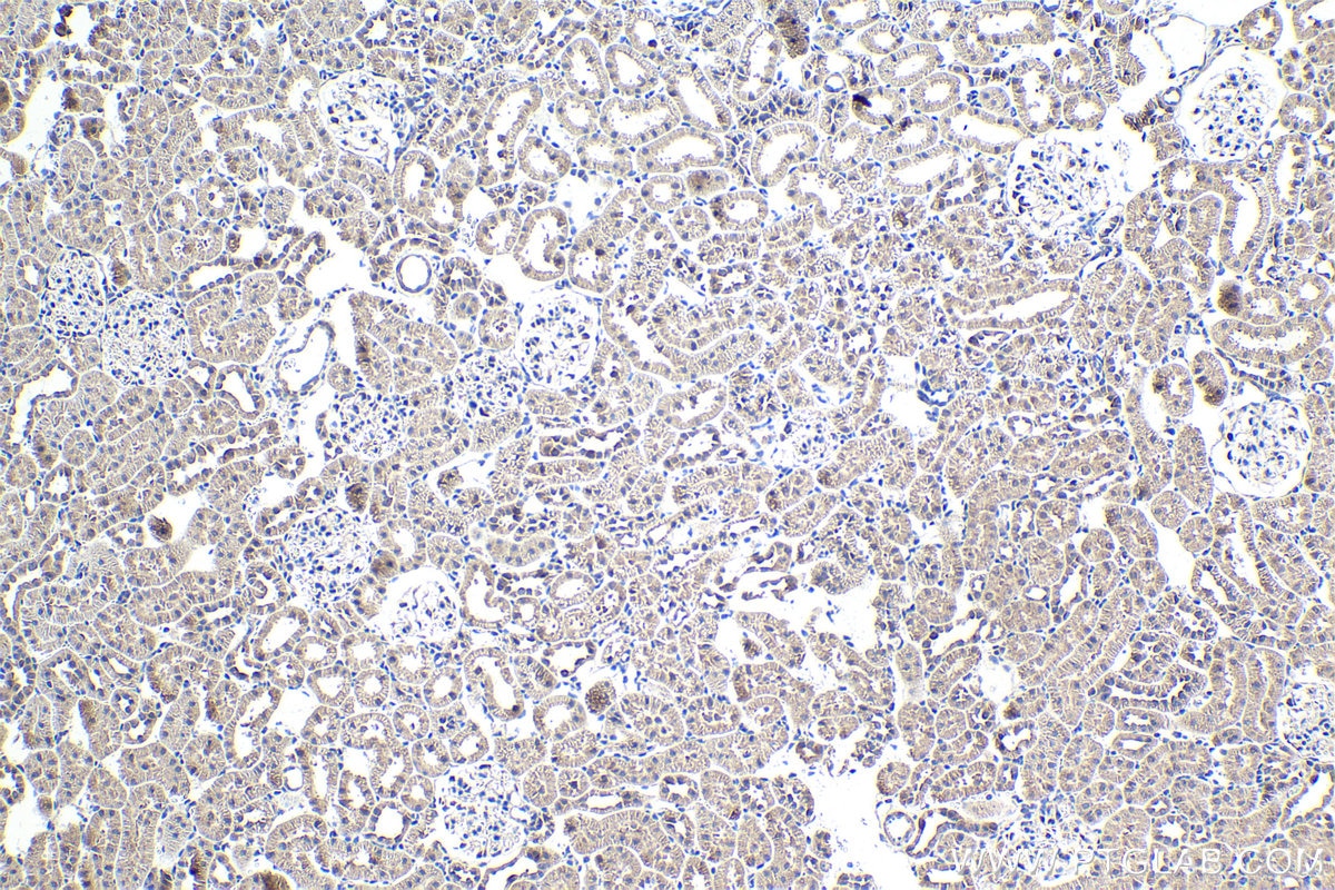 Immunohistochemistry (IHC) staining of rat kidney tissue using SAMD4B Polyclonal antibody (17723-1-AP)