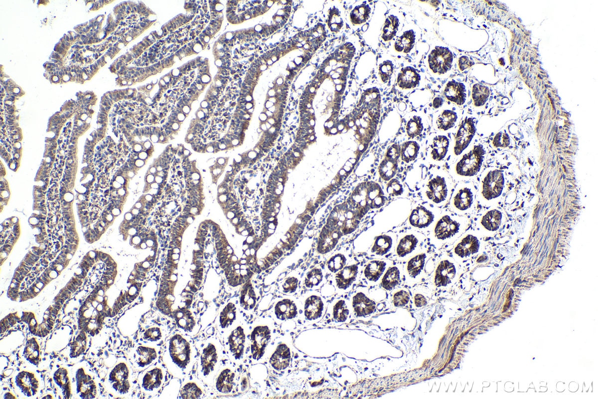 Immunohistochemistry (IHC) staining of rat small intestine tissue using SAMD4B Polyclonal antibody (17723-1-AP)