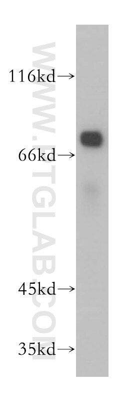 Western Blot (WB) analysis of mouse liver tissue using SAMD4B Polyclonal antibody (17723-1-AP)