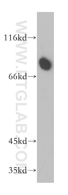 Western Blot (WB) analysis of mouse kidney tissue using SAMD4B Polyclonal antibody (17723-1-AP)