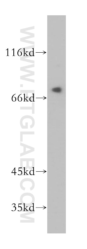 Western Blot (WB) analysis of HeLa cells using SAMD4B Polyclonal antibody (17723-1-AP)